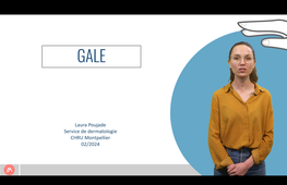 DUPEMG 4.4.3 La Gale