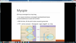 DFASM1 MID - Ophtalmo Pierre Pineau 1/2 (01/10/2020)