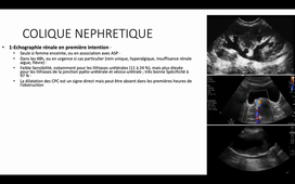 DR BENENATI ECHO VESICO RENALE.mp4