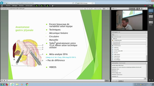 DU_PEC_Obésité_25042019_GAUTIER_Technique GASTRIC BYPASS en Y