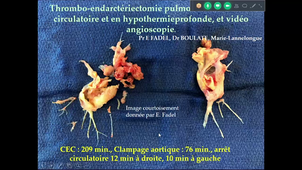 DU Battistella Insuffisance Cardiaque Pr Battistella 22 Mars 2019