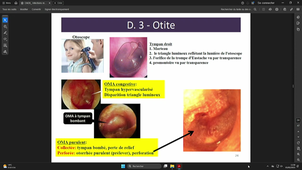 DFGSM3 - Pr.Godreuil - Agents Infectieux Partie Spécifique - Infections respiratoires et ORL 06/02/2025