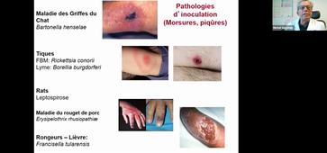 22/03/2021	16:00	17:00	DFGSM3 : Revêtement cutané : Les examens complémentaires en dermatologie (CM15)	Michel SEGONDY	Amphi Rabelais	DFGSM3