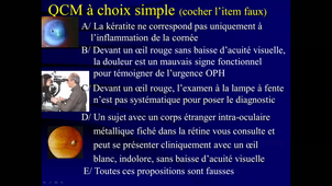 DFASM1 MID 11/12/2020 oeil rouge et/ou douloureux - Glaucome -Paupières - SEP (102)	M.VILLAIN 302 MID