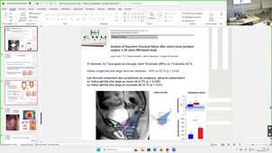 Video Pr DE TAYRAC - SUITE