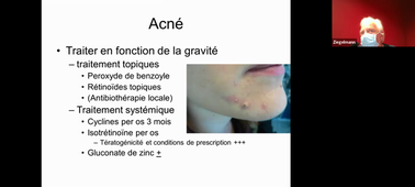 Mardi	04/01/2022	08:00	10:00	DERMATOLOGIE	BEST OF	O-DEREURE	AMPHI ZIEGELMANN