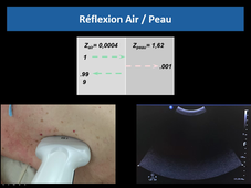 Imagerie et oncologie - Pr J. Frandon.mp4