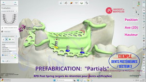 3SHAPE2025_PPAM MD 08 préfabrication.mp4