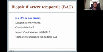 DFASM2 MIF 01/02/2021	16:00	18:00	Artérite à cellules géantes	GUILPAIN Ph.	salle 309	MIF