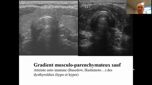 Imagerie en  endocrinologie : thyroïde et parathyroïde