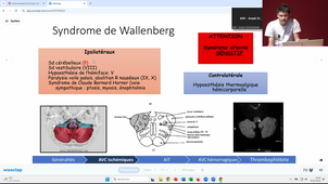 DFASM1 - BEST OF NEUROLOGIE - Dr. TER Schiphorst - 31/01/2025