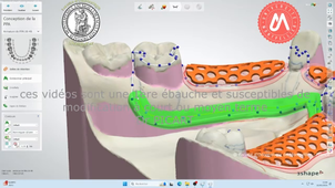 2024_MAND_K32_étape2.mp4