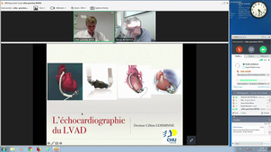 D.U Insuffisance Cardiaque Dr C GOEMINNE