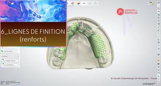 3SHAPE2025_PPAM MD 06 lignes de finition.mp4