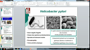 (29/10/2020) 11-12H Appareil digestif Pierre BLANC Amphi Rabelais DFGSM2