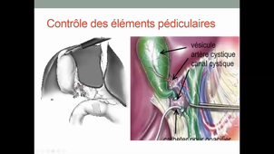 25/03/2021	10:00	12:00	Lithiase biliaire et complications, N° 320 - Ictère diagnostic	B. BENOUDIFA	301		MIB