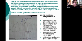 02/04/2021	15:00	16:00	Prise en charge d'une patiente atteinte de pré-eclampsie	DUPORT PERCIER Marie	308 	MIE