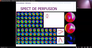 DFGSM3 - Module cardiovasculaire - Pr.Mariano-Goulart - 08/10/2026