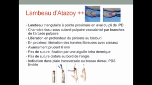 DU de chirurgie plastique pédiatrique Traumatisme de la main, Dr Marie-Christine Plancq 04/02/2021