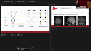 DFASM1 - Conférence DFASM1 Neurologie - 13/03/2025