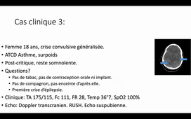 DR BENENATI ECHO GYN.mp4