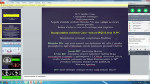 D.U Insuffisance Cardiaque CC Dr P BATTISTELLA