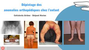 DUPEMG 3.9 : Dépistage des anomalies orthopédiques chez l'enfant - Jérôme Cottalorda