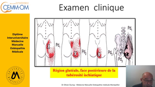 EPI Grand gluteal