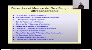 02 - Les bases du doppler