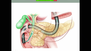 DFASM1 MIB (22/10/2020) L. PIRON  M. HERMIDA - MIB Indication de l'imagerie en pathologie abdominale et digestive. Stratégie bénéfice-risque + Lithiase biliaire et complications, N° 320 - Ictère diagnostic
