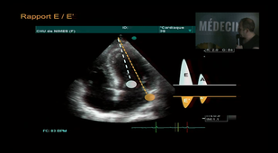 Echographie chez le patient critique