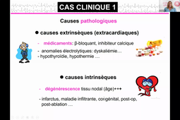 Atelier 10 - Troubles du Rythme Bradycardies Tachycardies - Iris Schuster