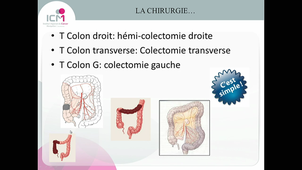 DFASM1 MIB - P.ROUANET -  G. CARRIER - Tumeurs du colon et du rectum  2/10/2020
