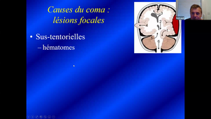 vidéo 15-04-2021-DFGSM2-B-CARLANDER-Système-neuro-CM18