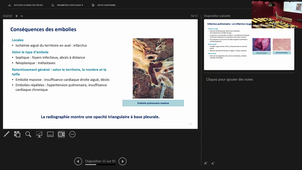 DFGSM3 - Anatomie pathologique de l'appareil circulatoire + La physiopathologie et les principes de la classification des vascularites - 21/10/2026