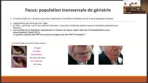 09-04-26-DFGSM2-Appareil digestif-sztajnzalc-CM18.mp4