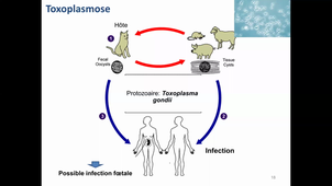 Yann Dumont CM32 Infections foetoplacentaires 22/01/2021