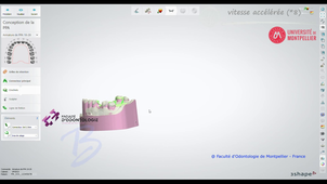 2026_3ShapeDM2025_conception maxillaire intégrale_vitessepar8.mp4