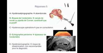 07/04/2021	10:00	11:00	Cancer de l'endomètre	FRANCINI Sarah	308		MIE