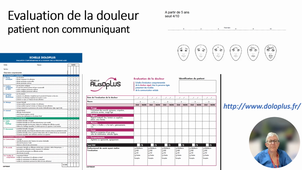 111 et 136 Evaluation de la douleur aigue-enregistré Pr BRUDER Nicolas.mp4