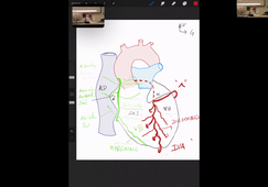 01-09-DFGSM3-Appareil cardio-M Prudhomme-CM1-2.mp4