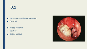DFASM1 MID - ORL Crampette / Psy T Michel / Psy N Rainteau - 08/09/2020