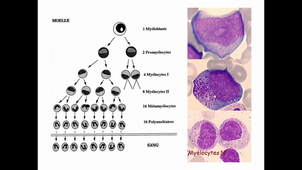 06/04/2021	14:00	16:00	Pathologie de la lignée leucocytaire maligne 2 (ED-2)	L. GABELLIER	