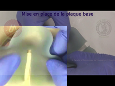 J4_PEI mand espacé totalement_confection résine