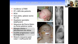 DU de chirurgie plastique pédiatrique 16h30 à 17h30, Pr Geneviève, génétique et malformations faciales 07/04/2021