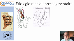 Syndrome de l'angulaire théorique