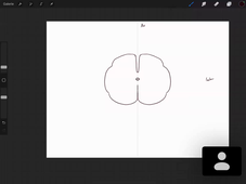 03-10-23-DFGSM2-CM3-Appareil neuro-M Bertrand.mp4