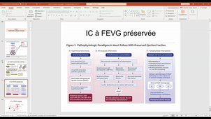 CM12 - Cardio/pneumo/vasc - Quentin DELBAERE - 29-04-2024