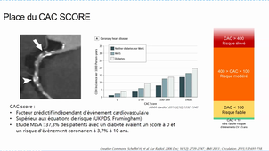 DU DIABETOLOGIE - Enregistrements cours - Lundi 20 novembre 2023.mp4
