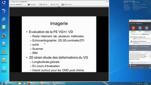 Pr P GIBELIN - Critères de gravité : hospitalisation, marqueurs biologiques, imagerie, ergoVO²